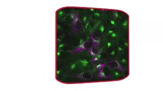 How to combine fluorescence and brightfield imaging [upl. by Nalon58]