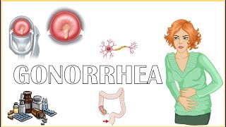 Gonorrhea  Causes Signs amp Symptoms Diagnosis And Treatment [upl. by Yht]