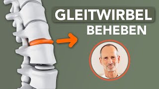 Was du bei Gleitwirbel tun kannst um dir selbst zu helfen gegen Rückenschmerzen [upl. by Liemaj364]