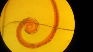 Trichuris trichiura male [upl. by Vharat]