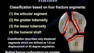 Proximal Humerus Fractures classification  Everything You Need To Know  Dr Nabil Ebraheim [upl. by Arielle]