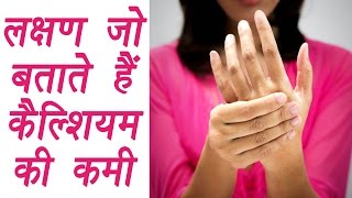 Calcium Deficiency Symptoms लक्षण जो बताते है कैल्शियम की कमी  Boldsky [upl. by Hirai999]