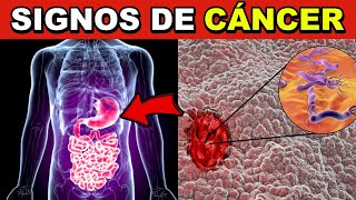 7 señales de alerta de CÁNCER DE ESTÓMAGO  síntomas SILENCIOSOS que NUNCA debes IGNORAR [upl. by Thgiled783]