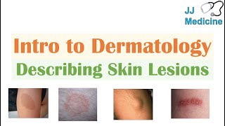 Introduction to Dermatology  The Basics  Describing Skin Lesions Primary amp Secondary Morphology [upl. by Aihseuqal372]