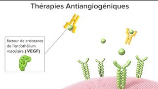 Les thérapies antiangiogéniques pour la DMLA humide  Animation [upl. by Akinuahs273]