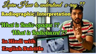 How to understand dental XRAY  Radiographic interpretation  dental radiograph [upl. by Tench258]