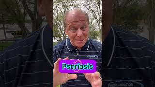 How do you say Psoriasis [upl. by Aneeh]