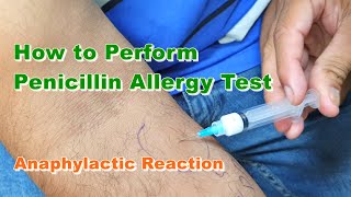 Penicillin G Allergy Test  Benzylpenicillin  Type 1 Hypersensitivity Reaction  How to Do [upl. by Alysoun]