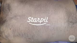 How to Wax Mens Back Hair  Full Back Hair Removal  Starpil Wax [upl. by Yenittirb]