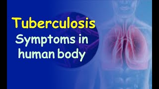 Tuberculosis Symptoms in Human Body [upl. by Enialed]