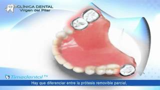 ¿Qué es una prótesis dental removible por Clínica Dental Virgen del Pilar [upl. by Phenice611]