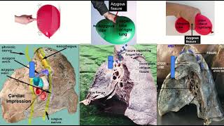 Azygos Vein amp Fissure on Radiology Xray CT amp MRI [upl. by Adiesirb]