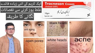 Tracnesan tretinoin cream reviewhow to apply tretinoin creamtretinoin cream skin benefits [upl. by Rillings]