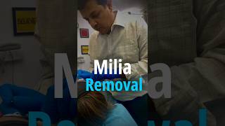 Unlock the Joy of Milia Removal at Dermalife 🔥🤩  Milia Removal Treatment  Milia Removal in Female [upl. by Aluk]