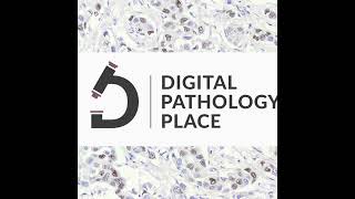 107 DigiPath Digest 13 Revolutionizing Pathology with AI Insights from PD1 to Prostate Cance [upl. by Deys]