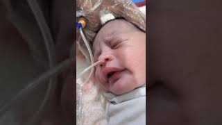 suction process in incubation newborn baby remove bad water from mouth and nose [upl. by Eno]