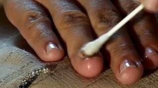 How to Cure Nail Fungus [upl. by Valma4]