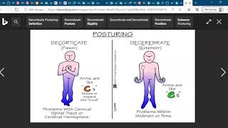 Decorticate and Decerebrate posturingNCLEX Exam Nursing Medical Student [upl. by Anniram364]