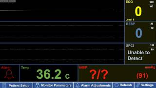 Simulated Adult Patient Monitor with Asystole Flatline – with Sound [upl. by Lavicrep]