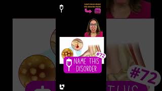 Name This Disorder 72 Medical Surgical SHORT  LevelUpRN [upl. by Barabas]