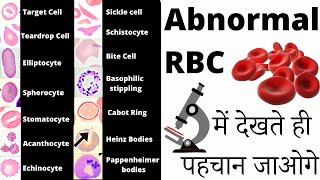 RBC Anomalies  RBC Abnormal Morphology  Inclusion bodies under microscope 🔬 [upl. by Jorry39]