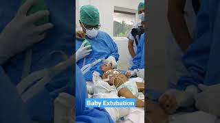 Baby Extubation after surgery [upl. by Etteoj]