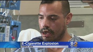 Tustin Man Recovering After ECig Explodes In His Mouth [upl. by Nicholle233]