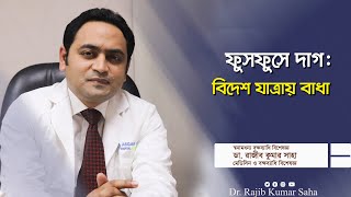 ফুসফুসে দাগCalcification  বিদেশ যাত্রায় বাধাস্বনামমধন্য বক্ষব্যাধি বিশেষজ্ঞ ডা রাজীব কুমার সাহা [upl. by Anier]