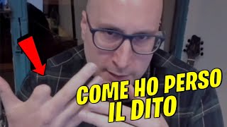 COME HO PERSO IL DITO [upl. by Klinger]