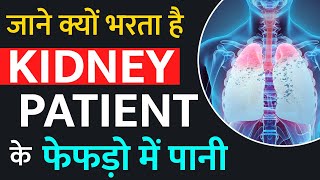 जाने क्यों भरता है kidney Patient के फेफड़ो में पानी  Pleural Effusion Causes  Symptoms [upl. by Sundberg]