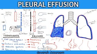 pleural effusion pathophysiology in Hindi part 1 [upl. by Luaped]