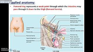 Overview of Lower Limb 33  Femoral Canal  Dr Ahmed Farid [upl. by Markman]