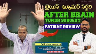 BRAIN TUMOR SURGERY  MENINGIOMA SURGERY  NEURO NAVIGATION  Dr BRAHMA PRASAD  APOLLO SECUNDERABAD [upl. by Eneleahcim]