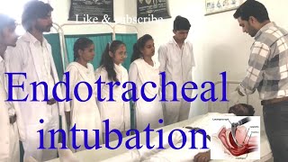 Endotracheal Tube  Intubation Procedure Ventilatior How to Insert Endotracheal TubeET Tube HINDI [upl. by Vassili302]