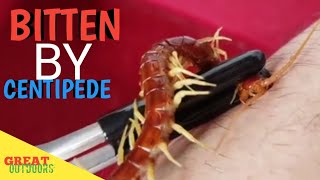 Floridas Giant centipede bite [upl. by Margalo449]