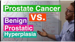 Benign Prostatic Hyperplasia vs Prostate Cancer [upl. by Schoenburg]