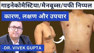 समझिये गायनेकोमैस्टिया को✅ कारणों से इलाज तक Gynecomastia From Causes to Cure  Dr Vivek Gupta [upl. by Oren]