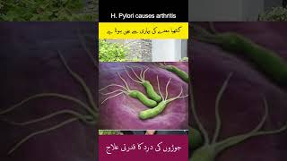 WARNING H Pylori Infection Could Be CAUSING Your Arthritis arthritis hpylori guthealth [upl. by Tur]