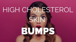 High cholesterol skin bumps and how to easily remove them [upl. by Goode310]