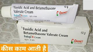 Fusidic Acid And Betamethasone Valerate Cream  Futop B Cream Uses Benefits amp Side Effects In Hindi [upl. by Minna42]