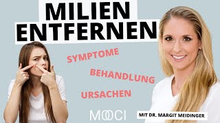 Milien  Wie kann man sie entfernen [upl. by Englis]