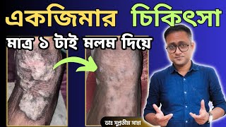 একজিমা  চুলকানি  LSC  Treatment  Only 1 cream  Dr Supratim Saha [upl. by Jennings749]