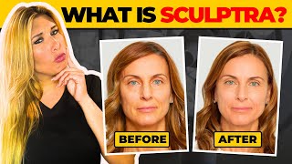 Sculptra What it is and its procedure [upl. by Arykat]