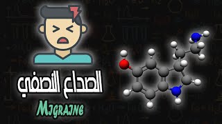 الصداع النصفي  Migraine [upl. by Ocnarfnaig]