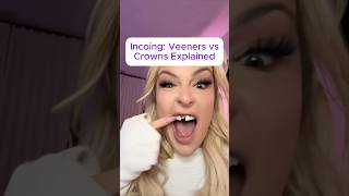 Veneers vs crowns veneers [upl. by Doggett882]