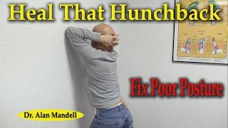 Heal That Hunchback and Fix Poor Posture Fast  Dr Alan Mandell DC [upl. by Conlan857]