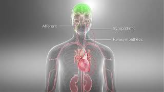 Barostim™ Baroreflex Activation Therapy Animation [upl. by Leterg]