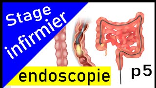 1 ère partie  Endoscopie digestive  rapport de stage bien détaillé [upl. by Urias]