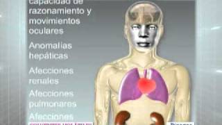 Todo sobre drogas Solventes volátiles IIIwmv [upl. by Flinn]