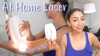 Laser Hair Removal at Home  Is is Effective  My Review  Permanent Hair Removal [upl. by Hesketh635]